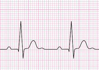 ECG