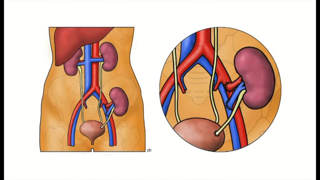 Nephrology